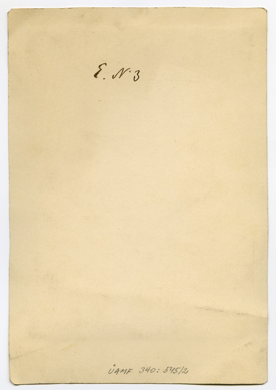 Foto haigusjuhtumist. Verbrennung... Põletus. Patsient Ader, Tõnnis.