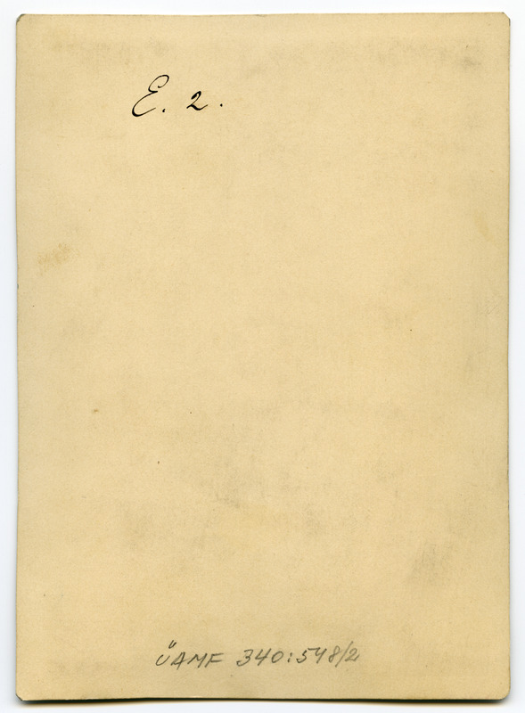 Foto haigusjuhtumist. Verbrennungsnarben in... Põletus.