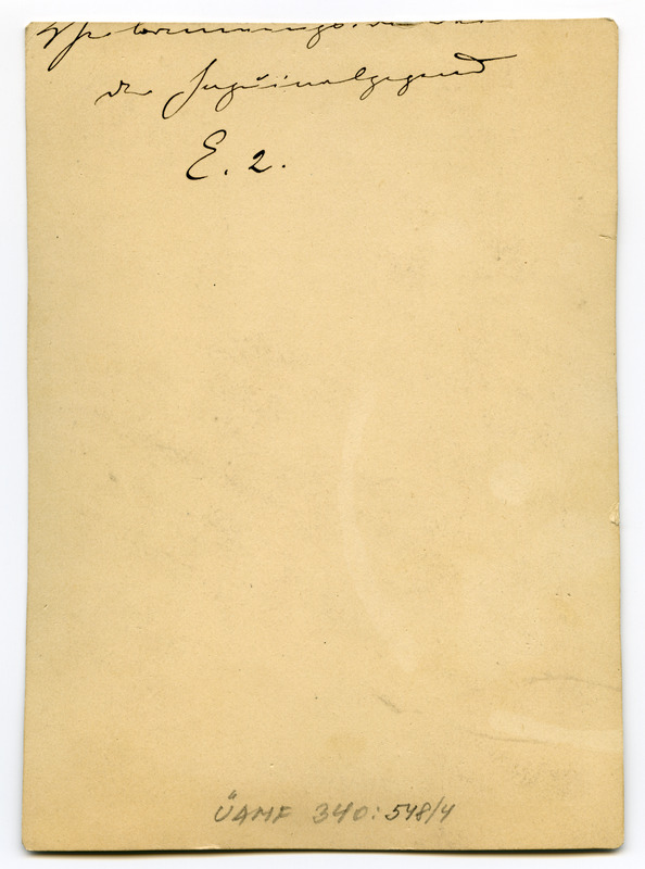 Foto haigusjuhtumist. Verbrennungsnarben in... Põletus.