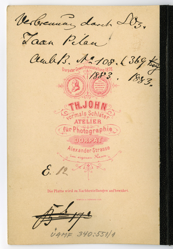 Foto haigusjuhtumist. Verbrennung durch SO3.  Põletus. Patsient Pillak, Jaan.