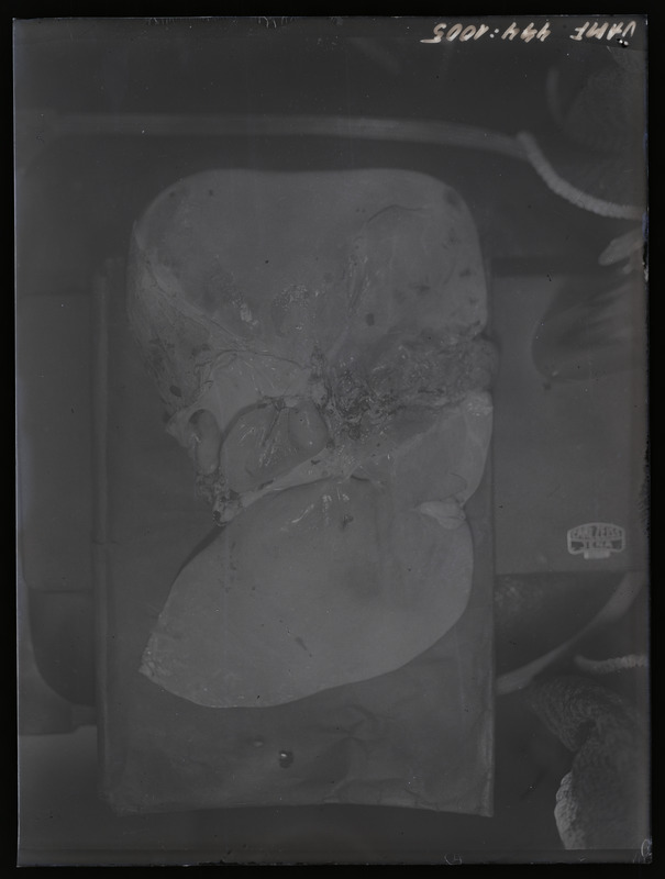 Füüsilise antropoloogia pildistus