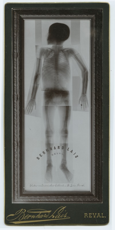 Röntgenographic Record of Man.