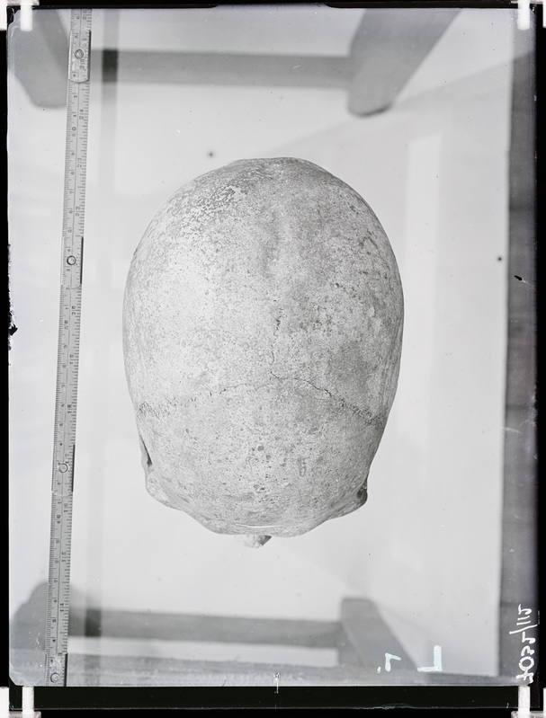 Arheoloogilised kaevamised. Loomõisa kivikirstkalmete leiukoht (Leoke talu). Kivikirstkalmest leitud kolju