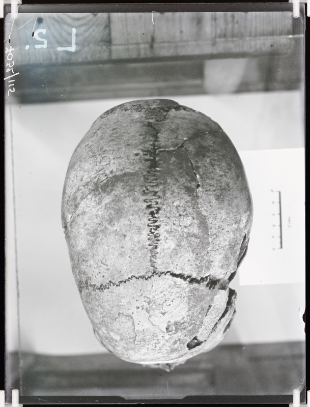 Arheoloogilised kaevamised. Loomõisa kivikirstkalmete leiukoht (Leoke talu). Kivikirstkalmest leitud kolju