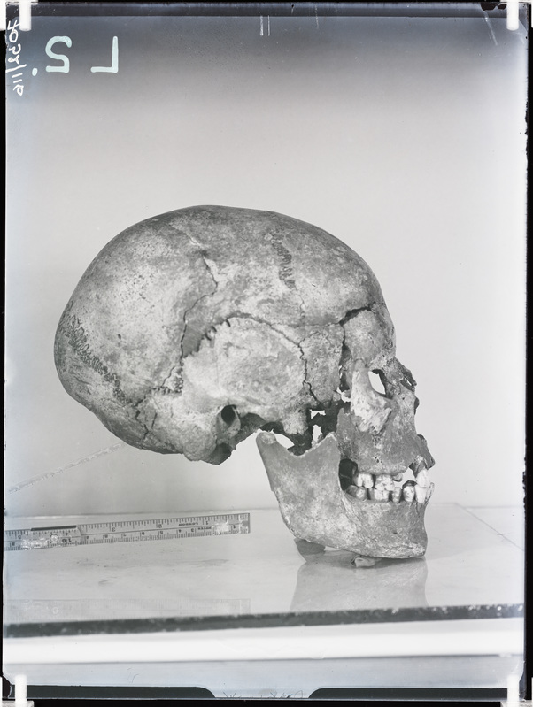 Arheoloogilised kaevamised. Loomõisa kivikirstkalmete leiukoht (Leoke talu). Kivikirstkalmest leitud kolju