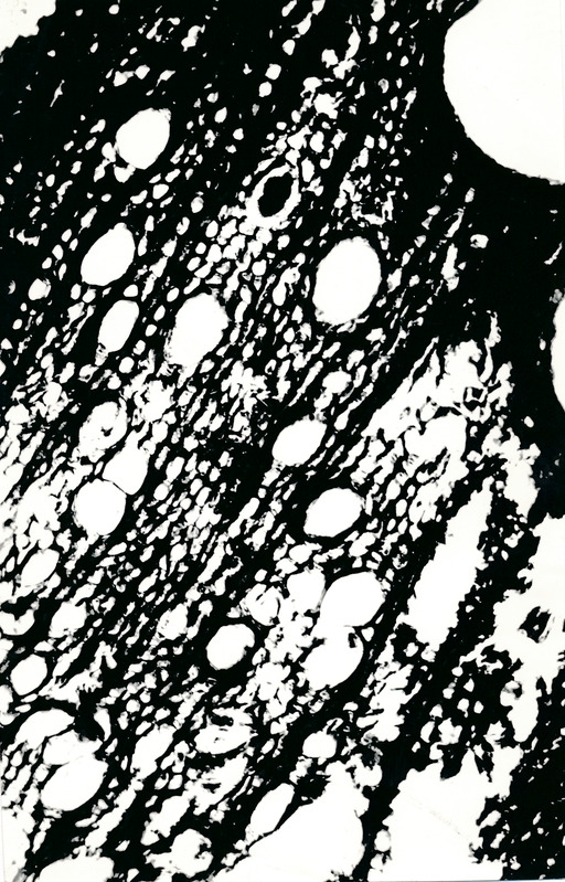 Arheoloogialeid. Tartu Jaani kiriku 1988. a arheoloogiliste uuringute käigus leitud Anna Elisabeth von Münnichi sarkofaagi restaureerimine.