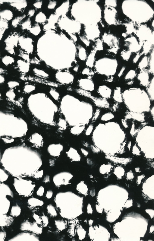 Arheoloogialeid. Tartu Jaani kiriku 1988. a arheoloogiliste uuringute käigus leitud Anna Elisabeth von Münnichi sarkofaagi restaureerimine.