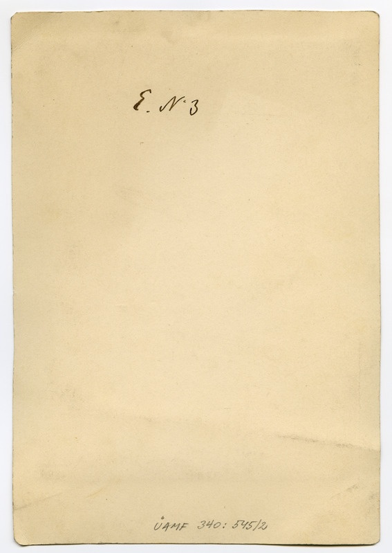 Foto haigusjuhtumist. Verbrennung... Põletus. Patsient Ader, Tõnnis.