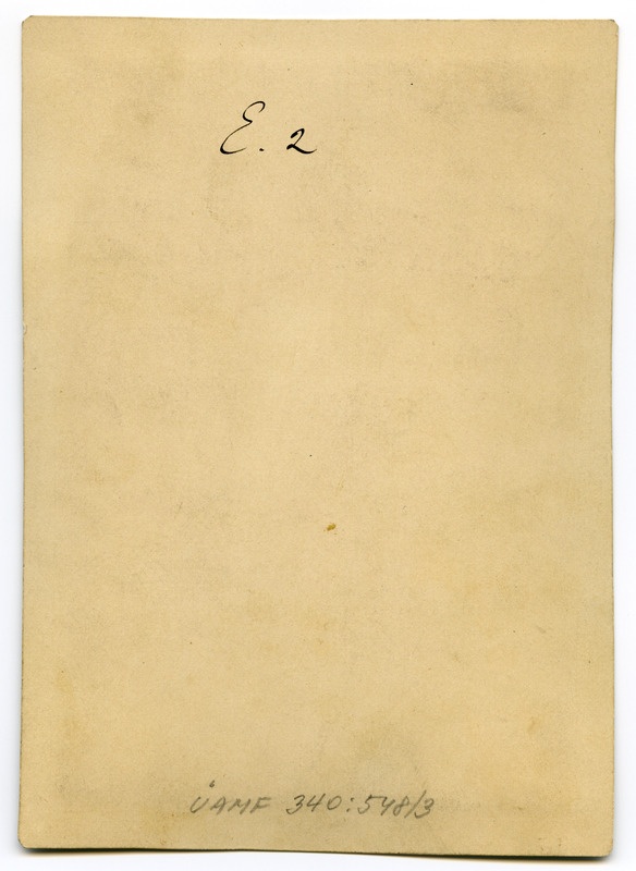 Foto haigusjuhtumist. Verbrennungsnarben in... Põletus.