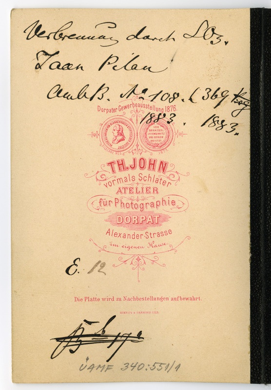 Foto haigusjuhtumist. Verbrennung durch SO3.  Põletus. Patsient Pillak, Jaan.