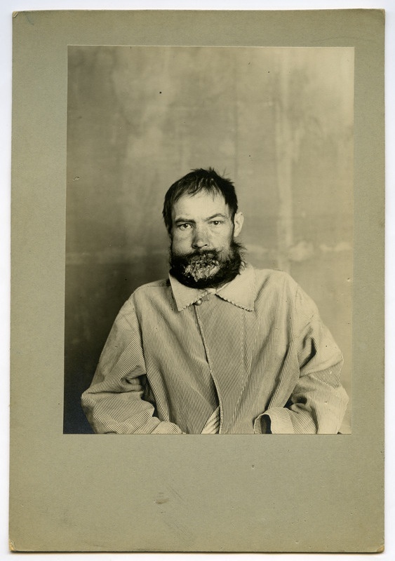 Noma