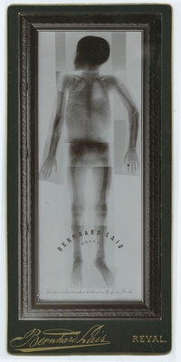 Röntgenographic Record of Man.  duplicate photo