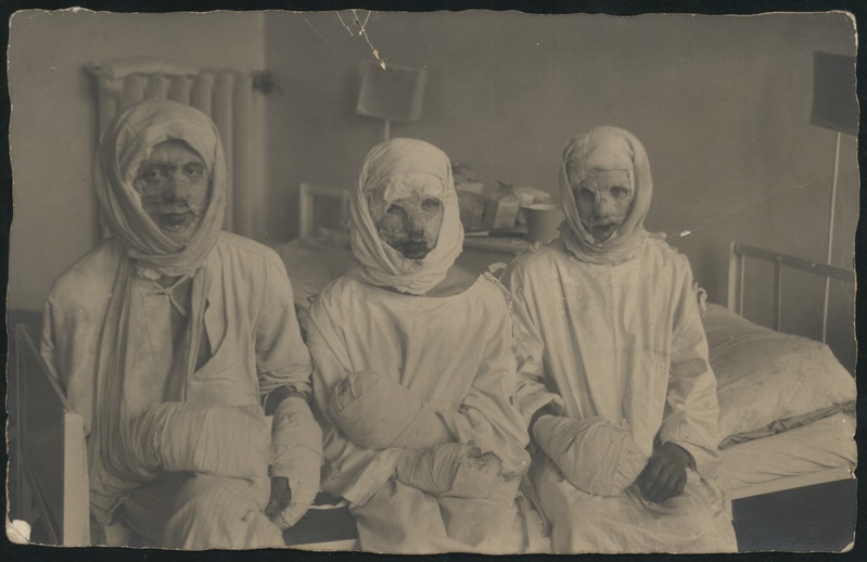 foto, Halliste khk, Abja Linavabrik, 3 1925. a vabriku põlengus kannatanut Pärnu haiglas, u 1925