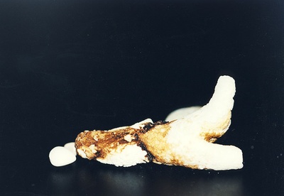 Neeruvaagnakivid  duplicate photo