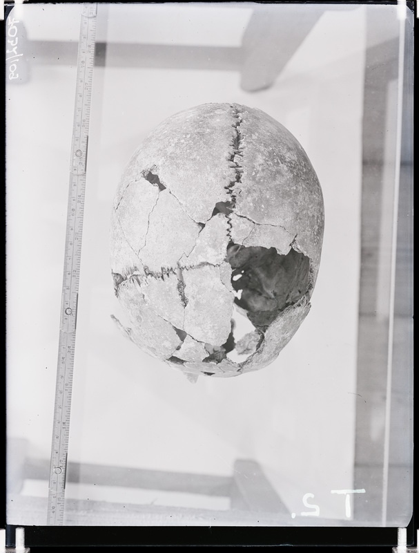 Arheoloogilised kaevamised. Loomõisa kivikirstkalmete leiukoht (Toomani talu). Kivikirstkalmest leitud kolju