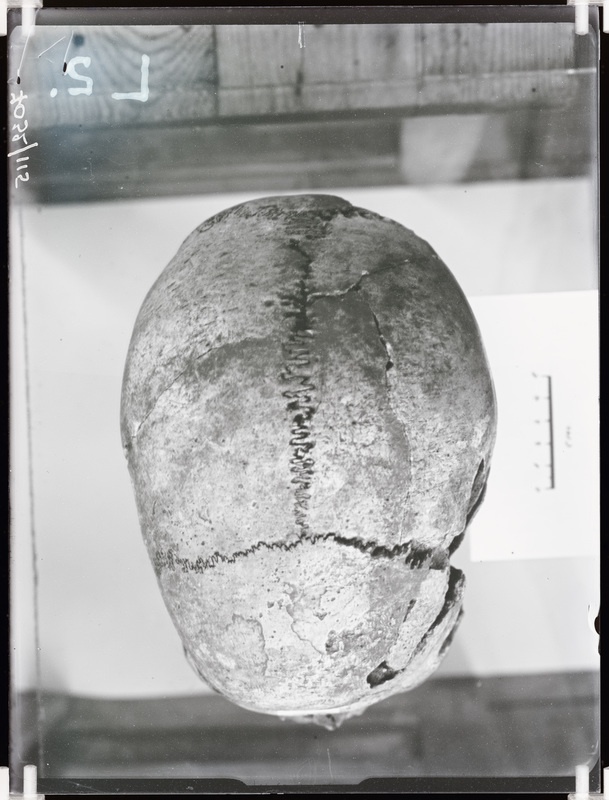 Arheoloogilised kaevamised. Loomõisa kivikirstkalmete leiukoht (Leoke talu). Kivikirstkalmest leitud kolju