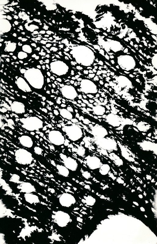 Arheoloogialeid. Tartu Jaani kiriku 1988. a arheoloogiliste uuringute käigus leitud Anna Elisabeth von Münnichi sarkofaagi restaureerimine.