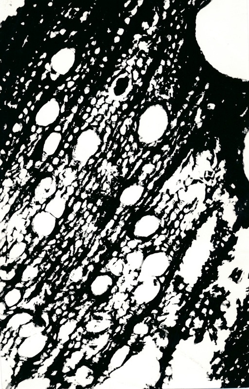 Arheoloogialeid. Tartu Jaani kiriku 1988. a arheoloogiliste uuringute käigus leitud Anna Elisabeth von Münnichi sarkofaagi restaureerimine.