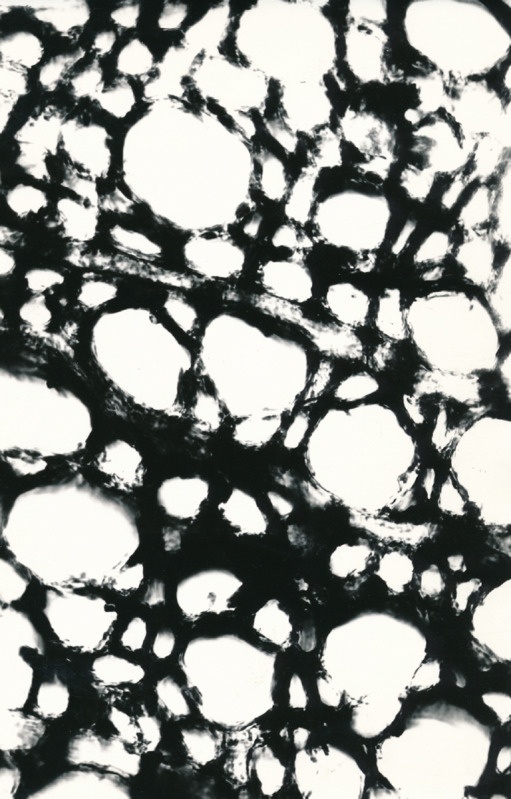 Arheoloogialeid. Tartu Jaani kiriku 1988. a arheoloogiliste uuringute käigus leitud Anna Elisabeth von Münnichi sarkofaagi restaureerimine.