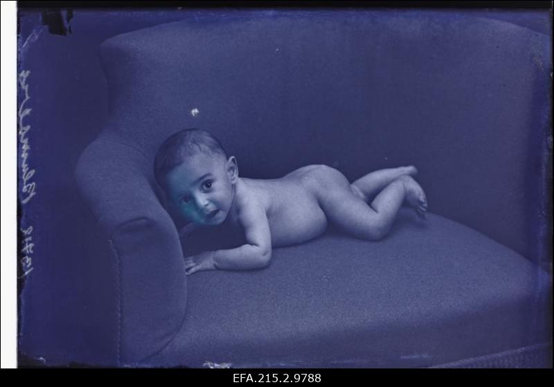Blumbergi laps.