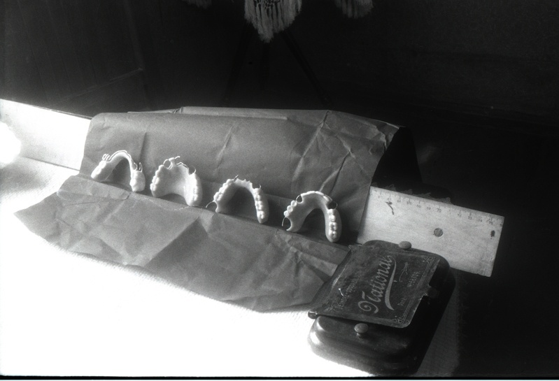 Hambaprotees (stomatoloogia)