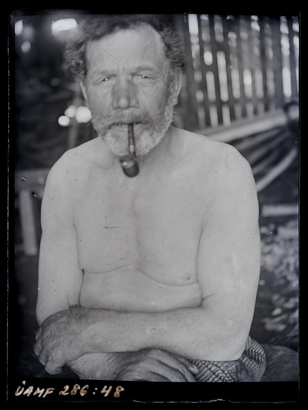 Mees piibuga/näol haigusnähud?