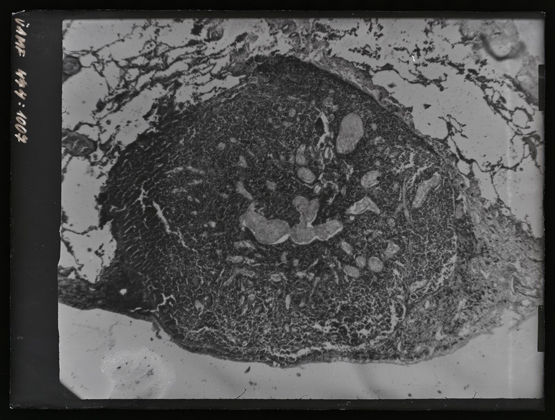 Füüsilise antropoloogia pildistus