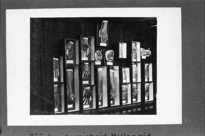 Kutsehaigusi käsitlev ekspositsioon Eesti Tervishoiu Muuseumis.  duplicate photo